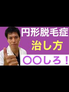 [x]【円形脱毛症①】その円形脱毛症が すると治るって知ってた？最新治療法から今の治療法の欠点まですべてを解説 - YouTube